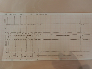 心電図ポポ１