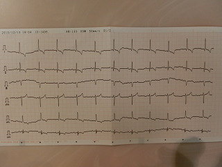 心電図ぽぽ２